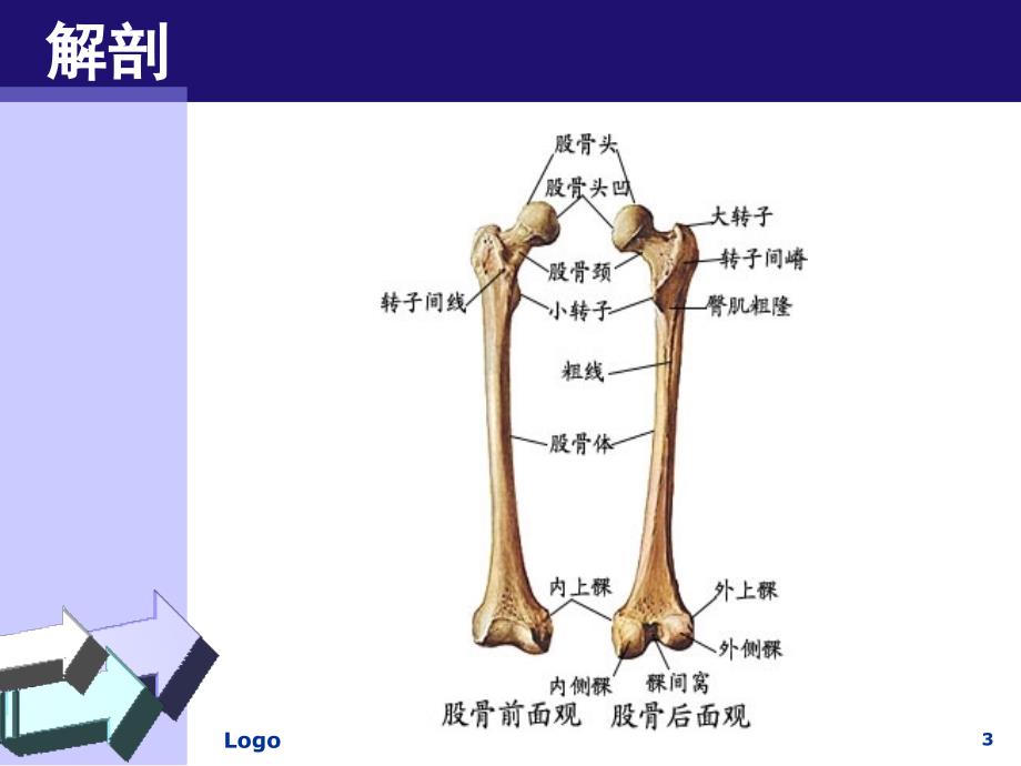 股骨干骨折患者的护理PPT课件_第3页