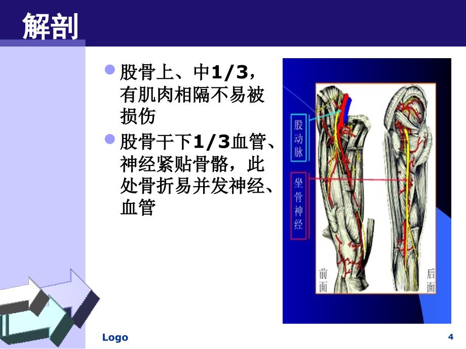 股骨干骨折患者的护理PPT课件_第4页