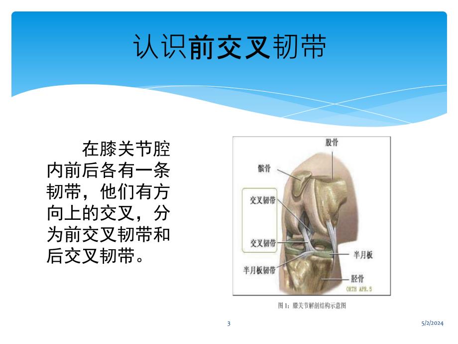 前交叉韧带损伤的教学查房参考课件_第3页