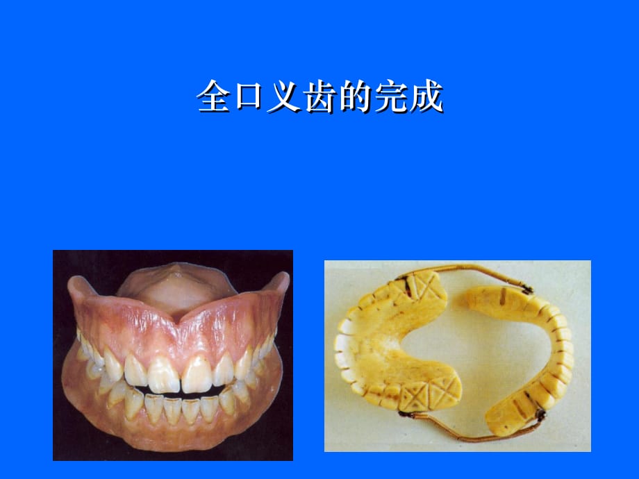 全口义齿制作步骤参考_第1页