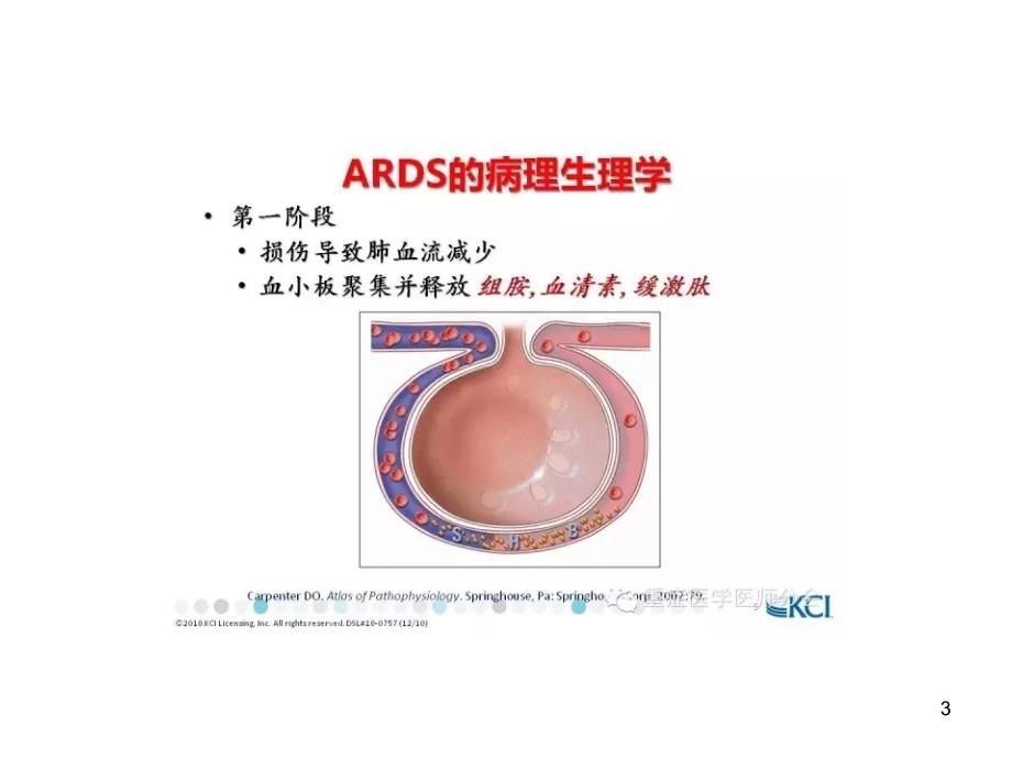 ARDS分级分期参考_第3页