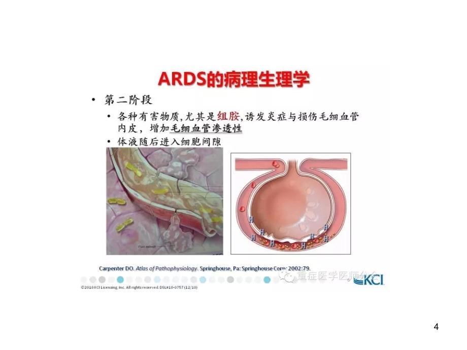 ARDS分级分期参考_第4页