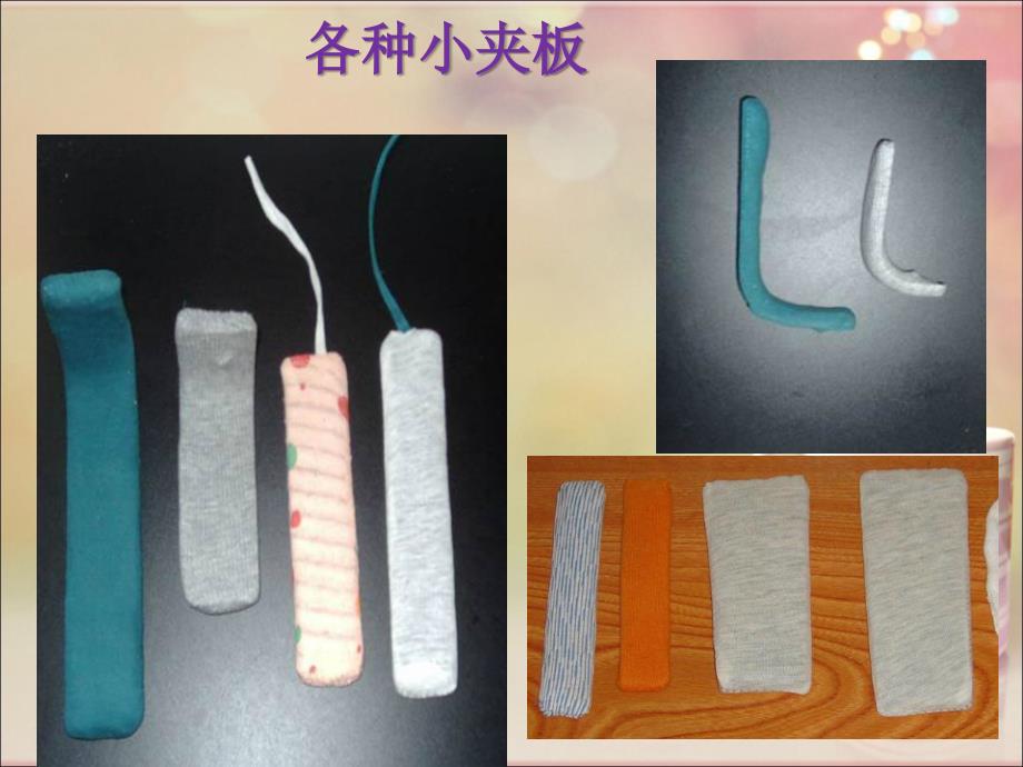 夹板固定术护理参考课件_第4页