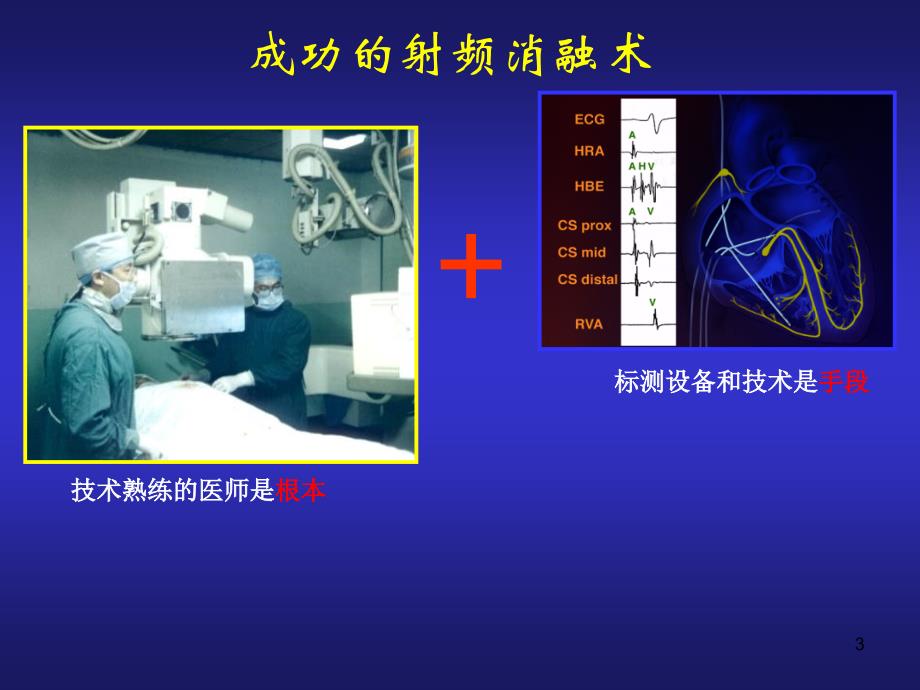 心脏电生理介入治参考_第3页