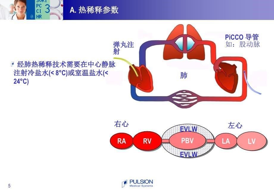 PiCCO血流动力学监测PPT参考幻灯片_第5页