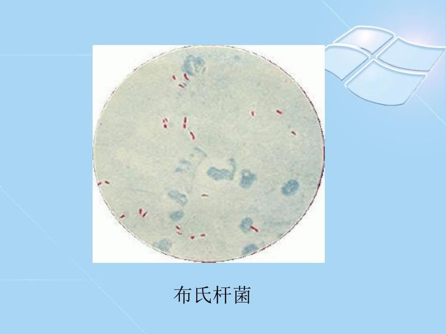 革兰氏阴性需氧杆菌医学课件_第5页