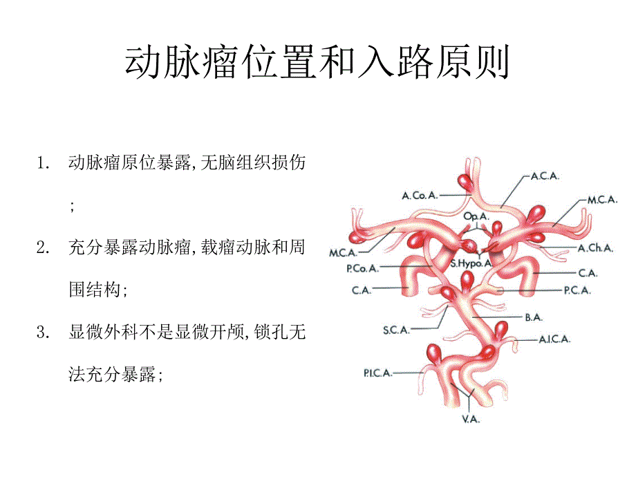 颅内动脉瘤手术入路ppt课件_第2页