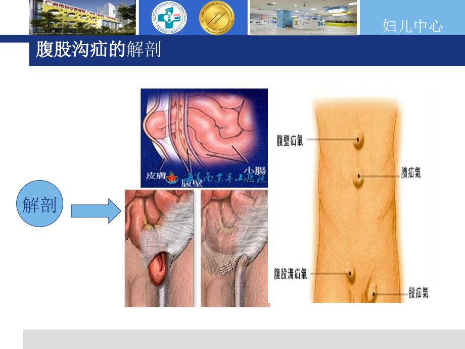 腹股沟疝的护理医学课件_第4页