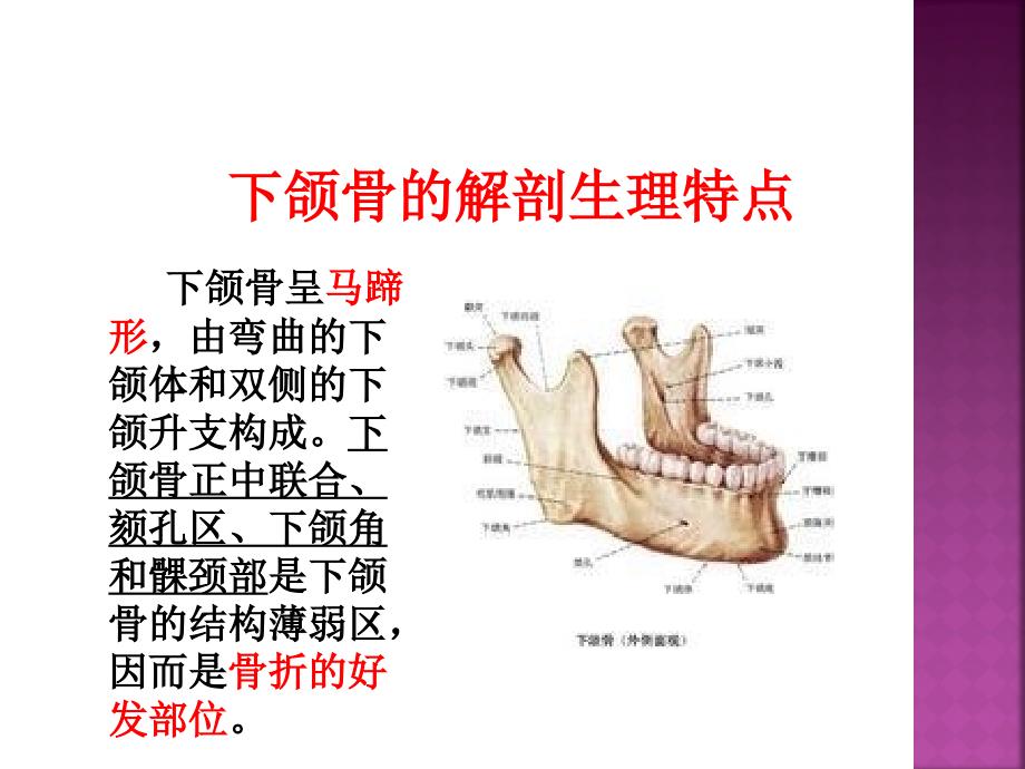 下颌骨骨折的护理_查房_第3页