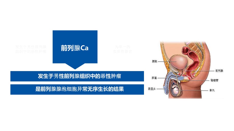 腹腔镜下前列腺癌医学课件_第4页