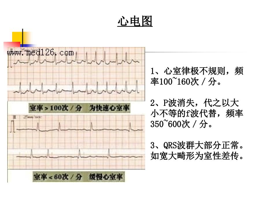 房颤射频消融术医学课件_第4页