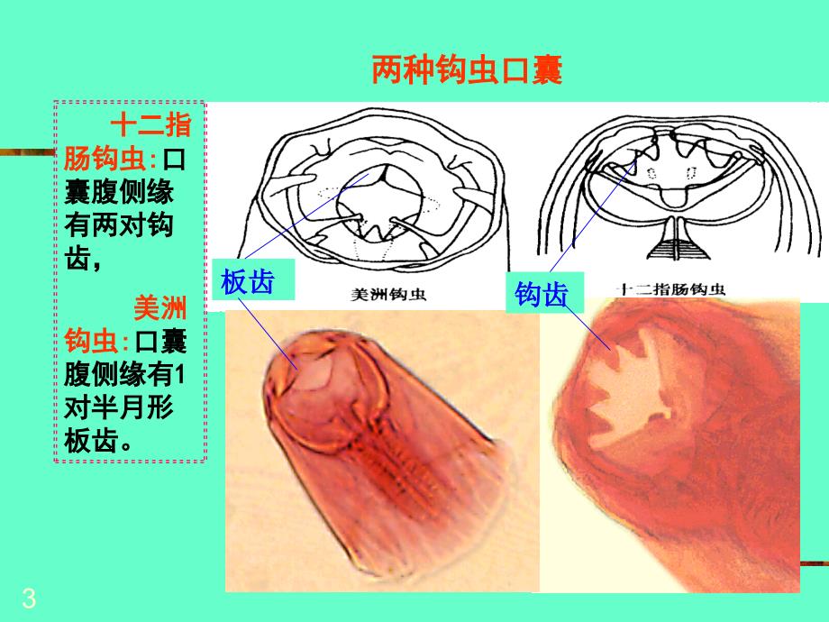 钩虫医学课件_第3页