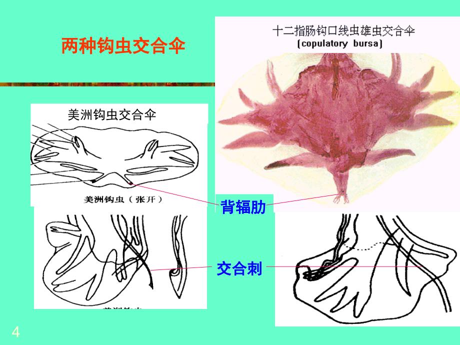 钩虫医学课件_第4页