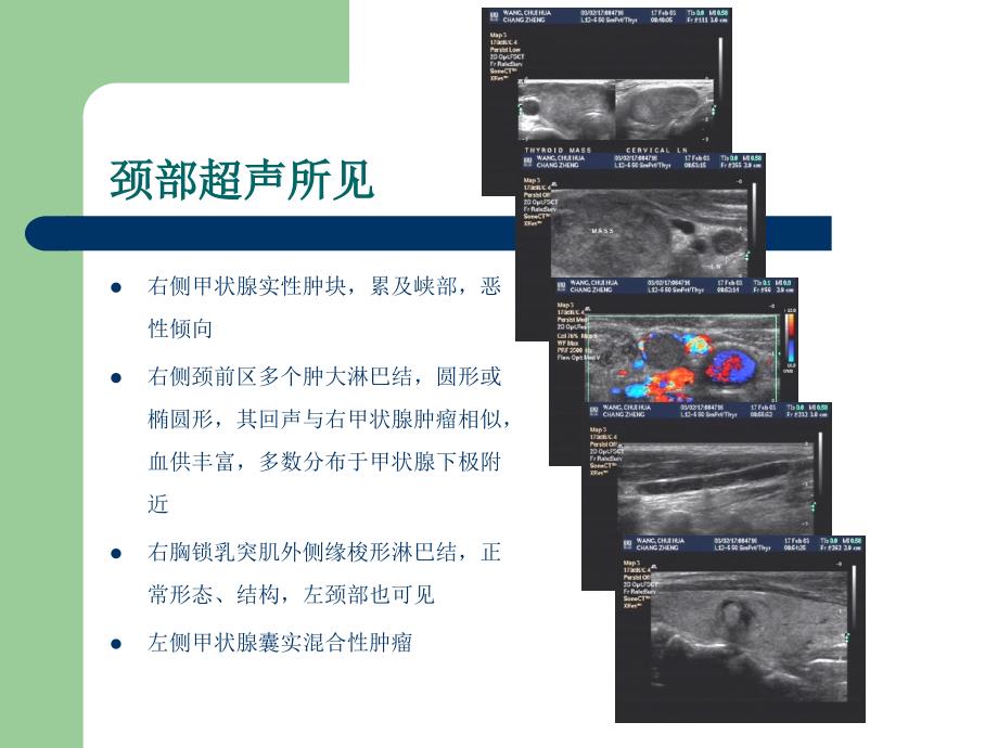 超声疑难病例正误诊分析ppt课件_第4页