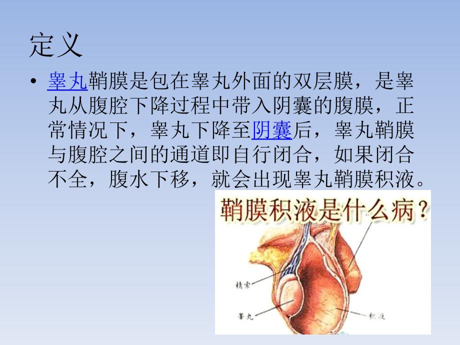 睾丸鞘膜积液教案资料_第2页