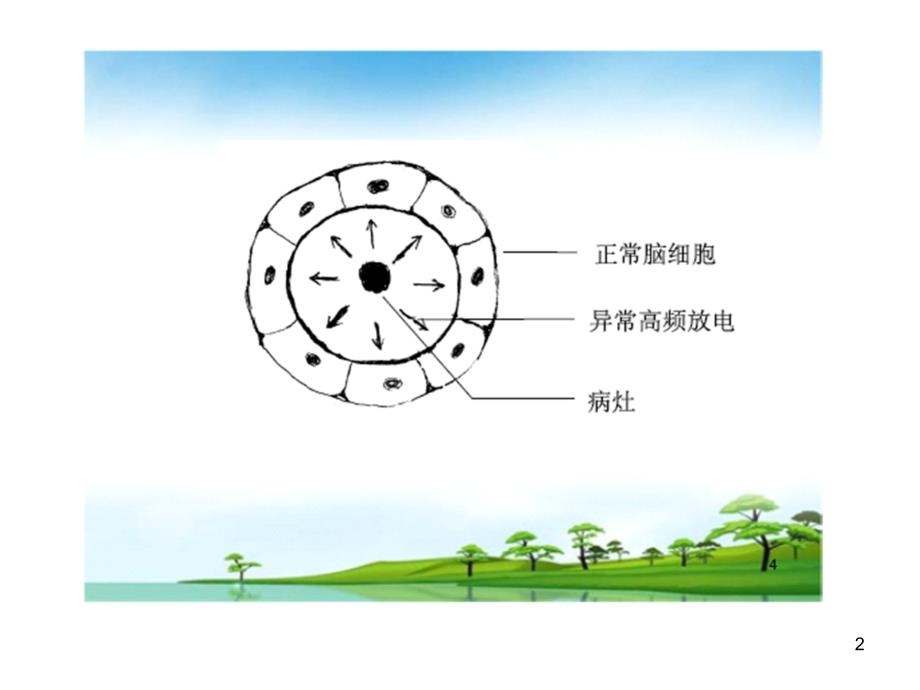 局限型癫痫的治疗措施医学课件_第2页