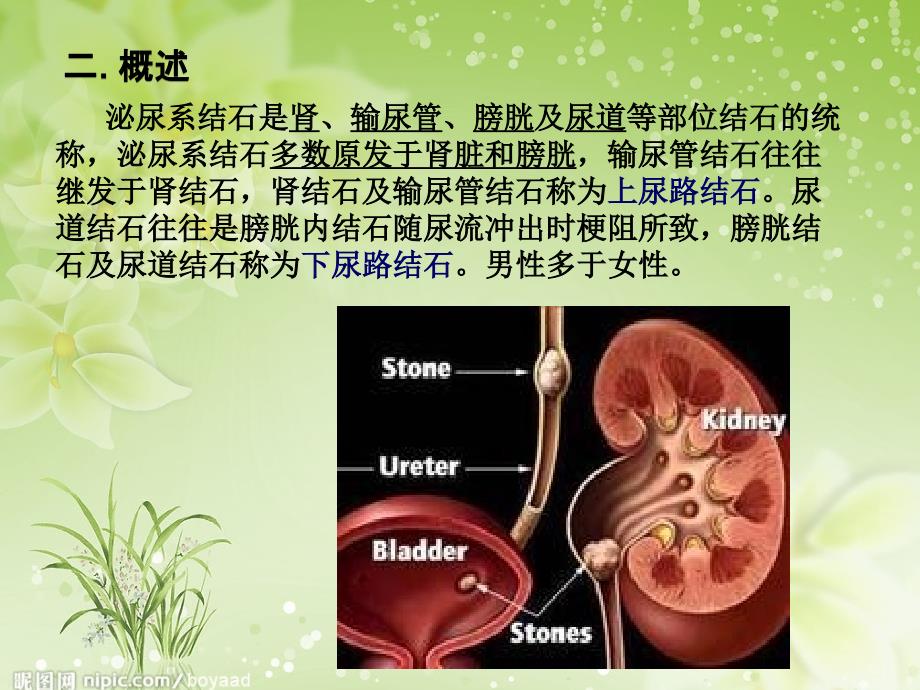 泌尿系结石ppt医学课件_第4页