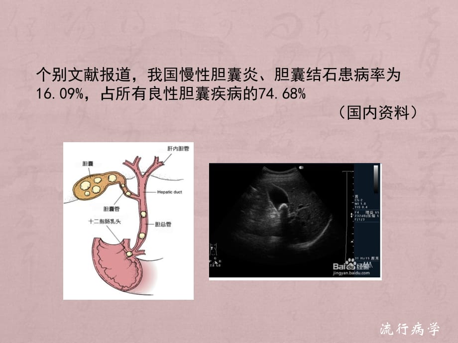 慢性胆囊炎胆囊结石诊疗共识意见ppt医学课件_第4页