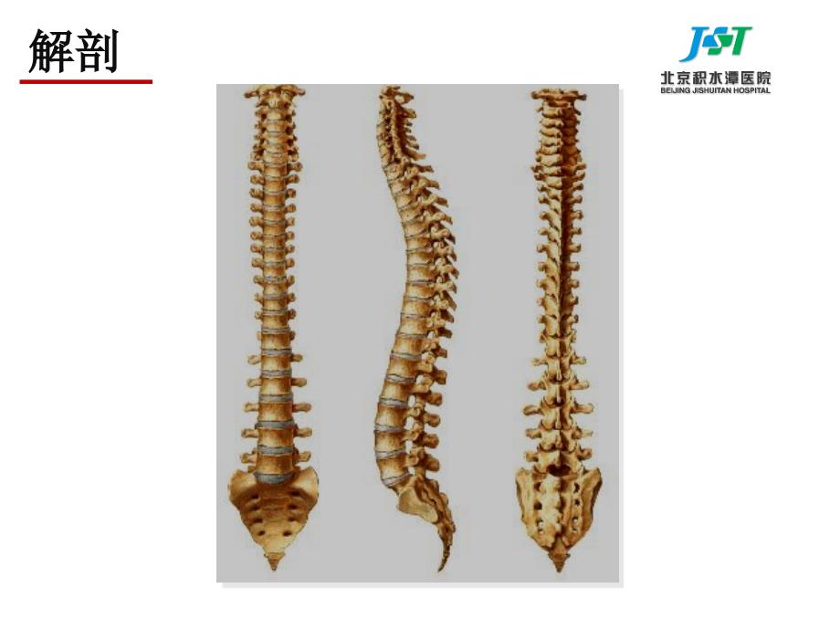 腰椎骨折医学影像医学课件_第3页