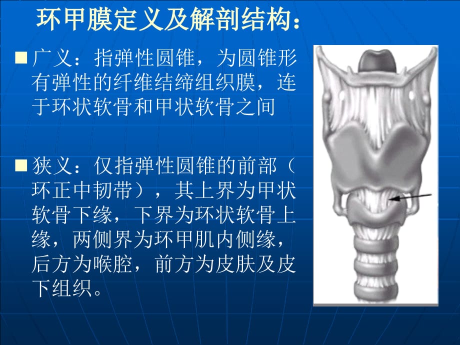 环甲膜穿刺术ppt医学课件_第2页