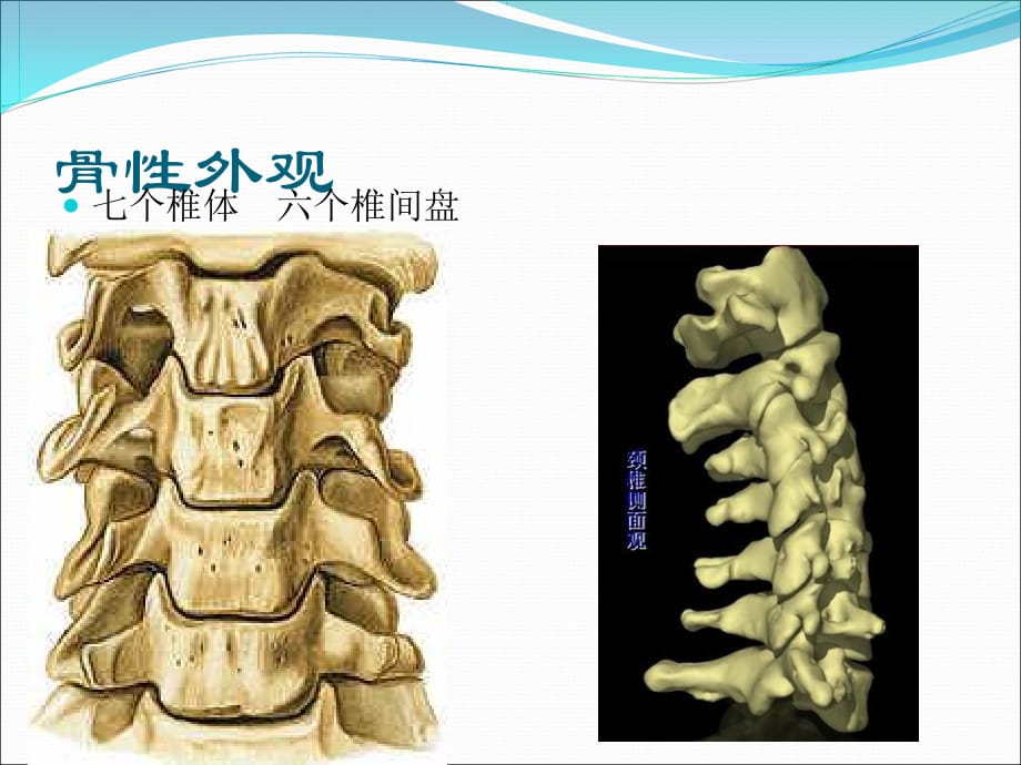 颈椎病健康教育ppt医学课件_第4页