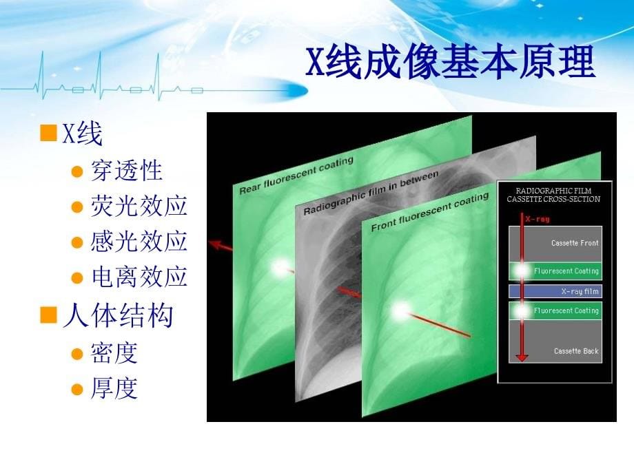 胸部影像解剖医学课件_第5页