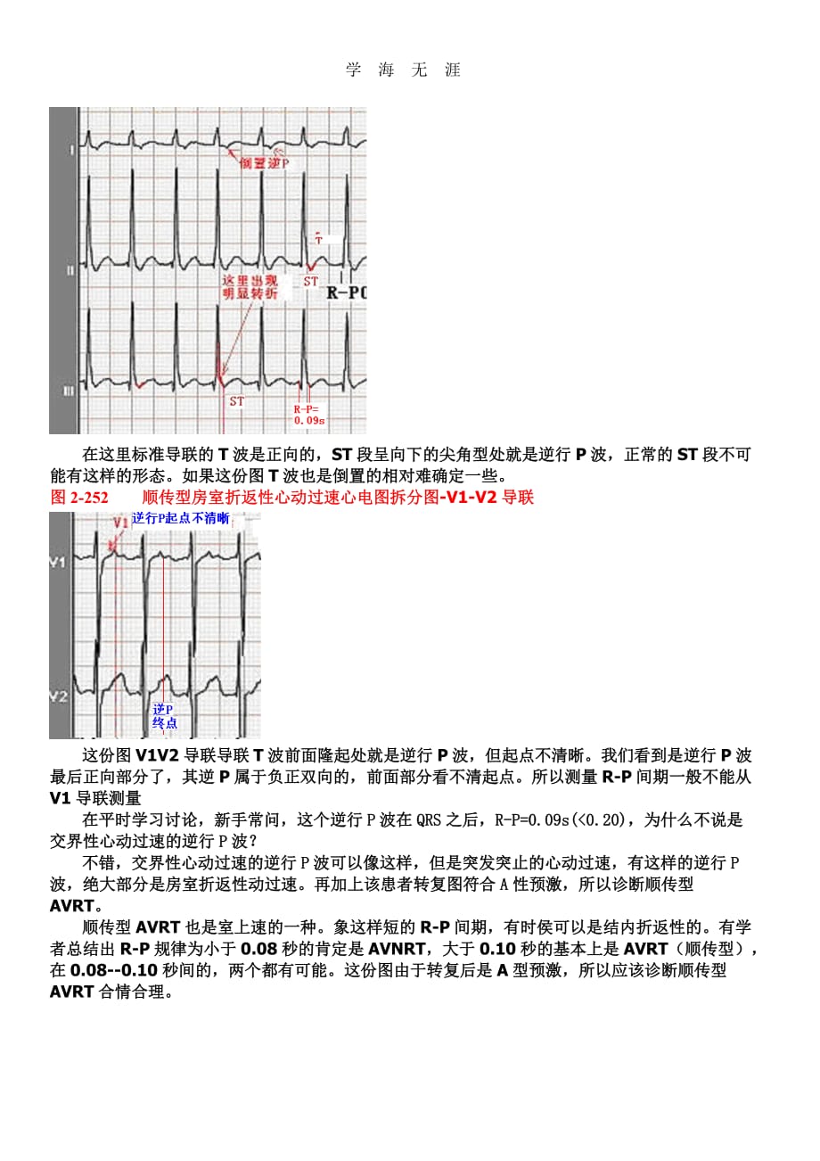 2020年另类心电图讲义-8---折返性心律失常_第2页