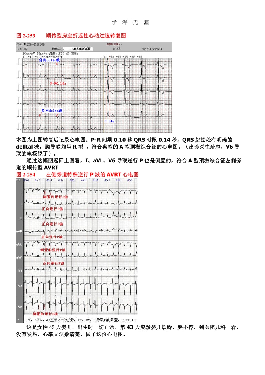 2020年另类心电图讲义-8---折返性心律失常_第3页