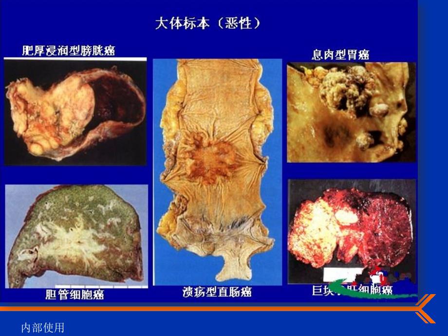 肿瘤学概论医学课件_第3页