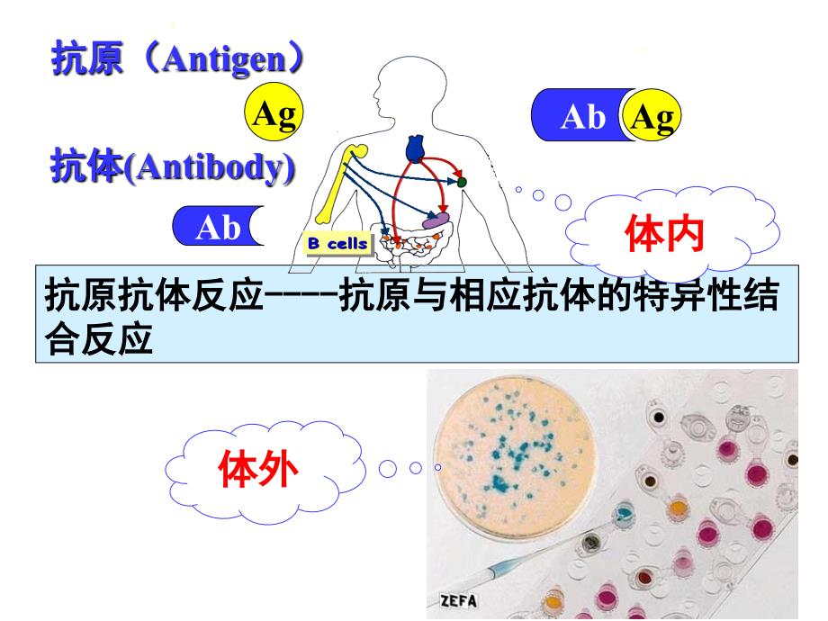 体外抗原抗体反应概述ppt医学课件_第3页