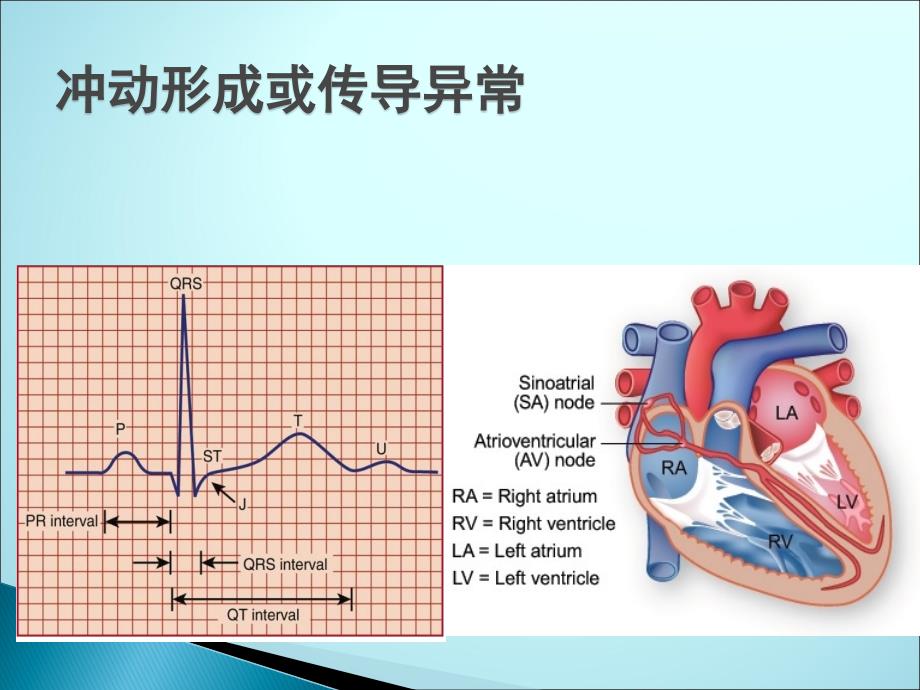 手术麻醉期心律失常ppt医学课件_第2页