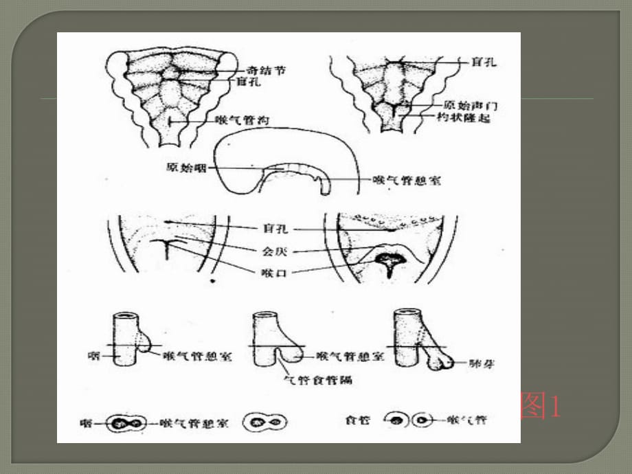 胎儿肺部发育特点ppt医学课件_第3页