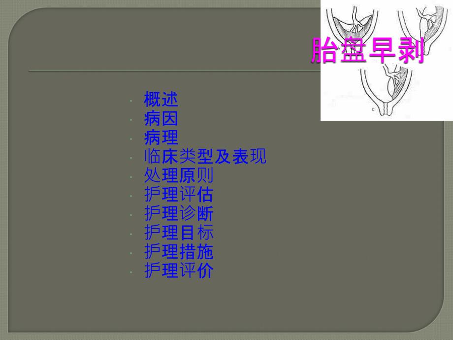 胎盘早剥护理ppt医学课件_第2页