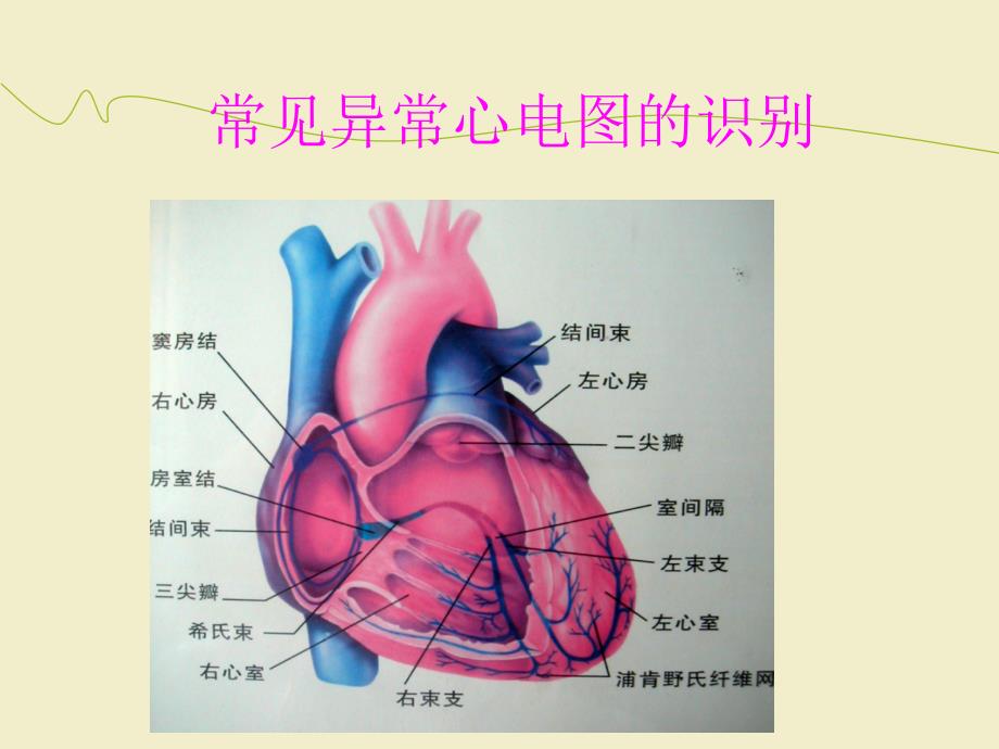 正常心电图及常见异常心电图的识别及处理ppt医学课件_第2页