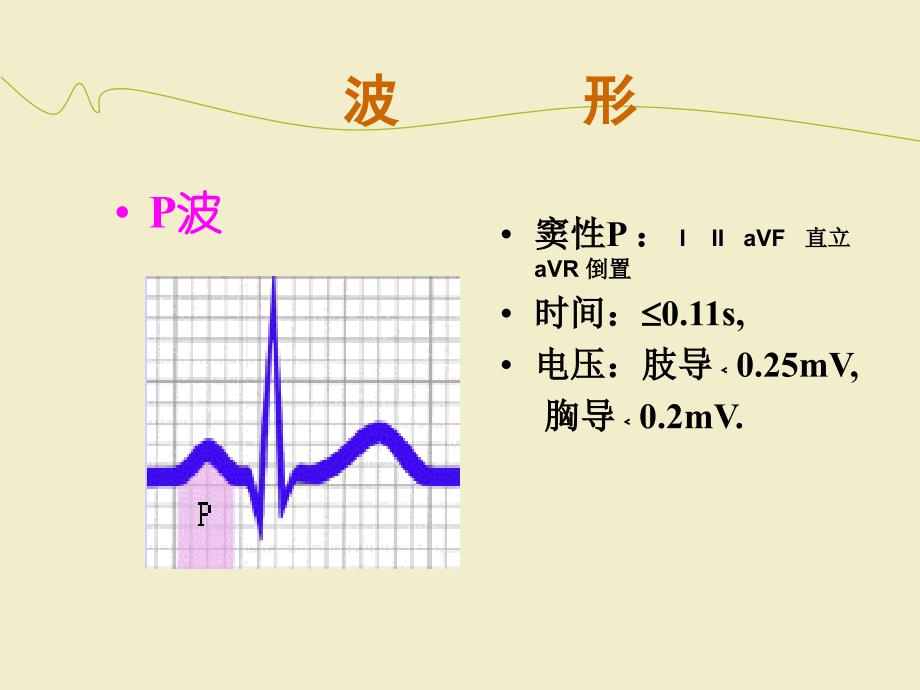 正常心电图及常见异常心电图的识别及处理ppt医学课件_第4页