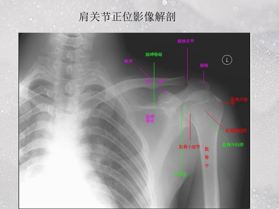 肩关的摄影体位ppt医学课件_第3页