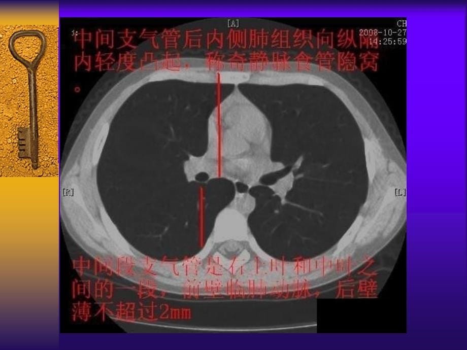 胸部断层解剖标注详解医学课件_第5页