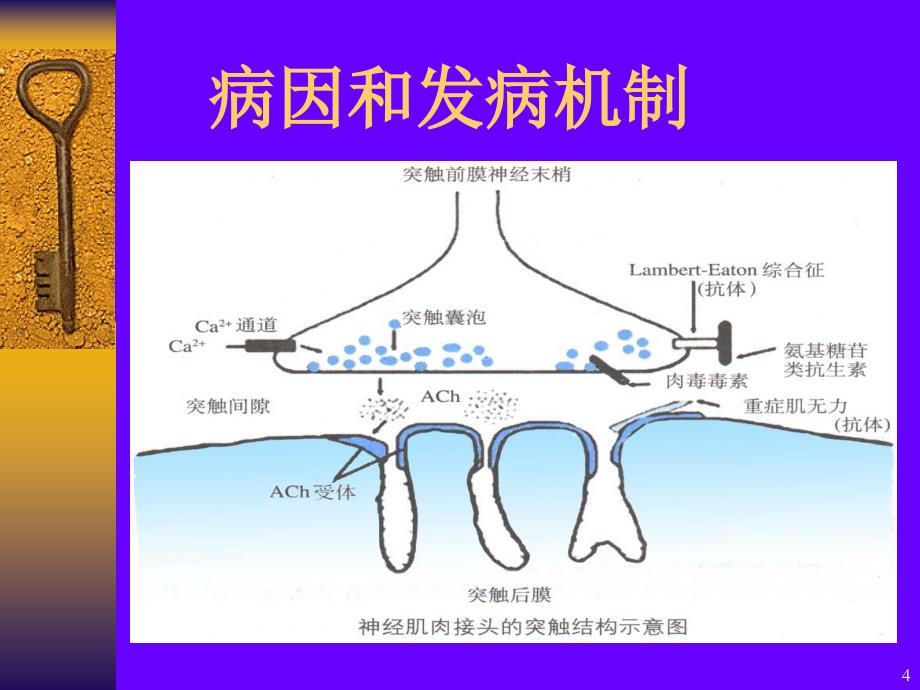 重症肌无力周期性瘫痪区别 ppt医学课件_第4页