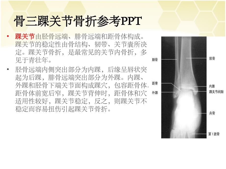 骨三踝关节骨折参考PPT_第3页