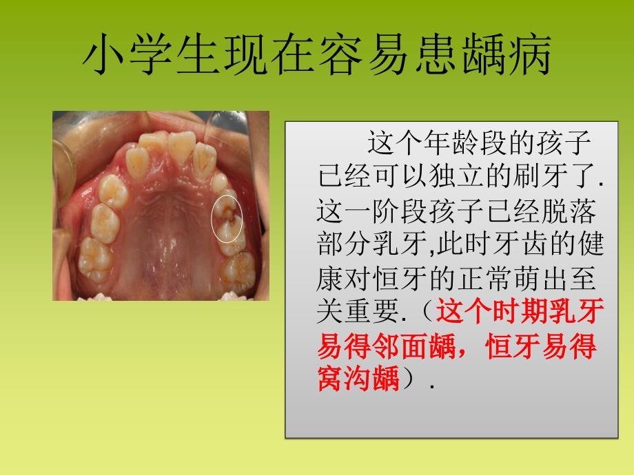 小学生口腔保健课 ppt医学课件_第4页