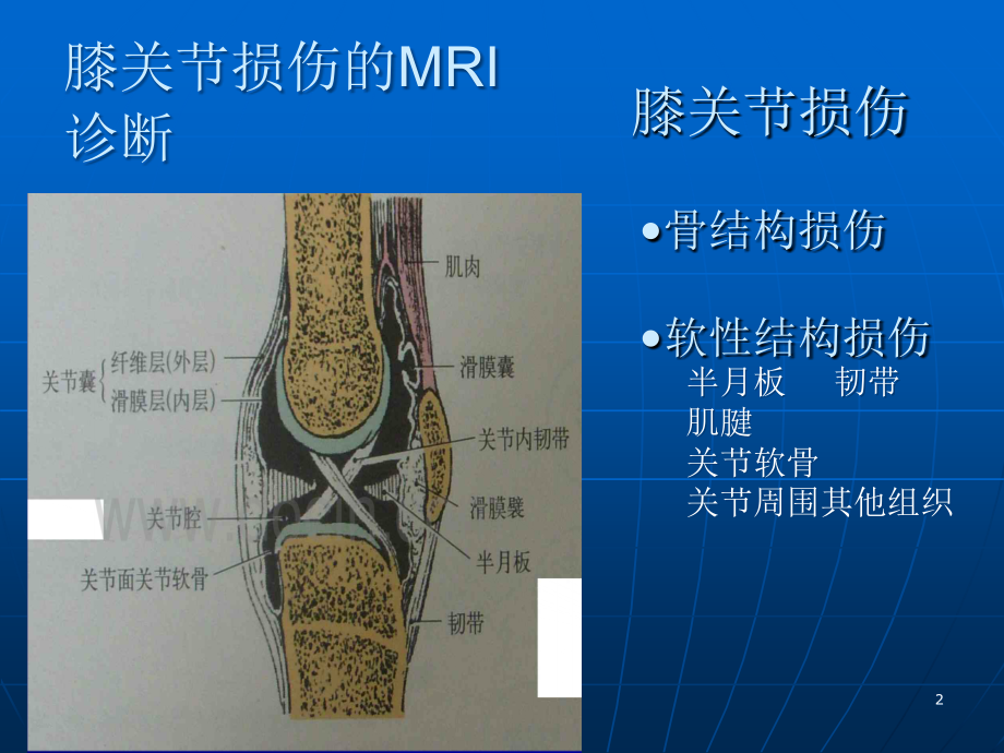 膝关节损伤的MRI诊断参考PPT_第2页