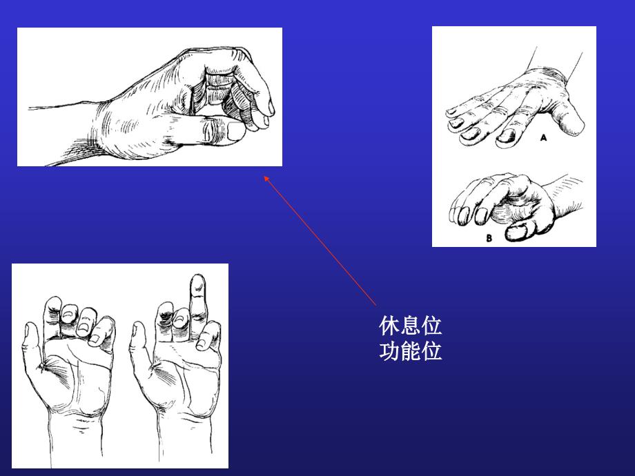 手外伤及断肢再植参考PPT_第4页