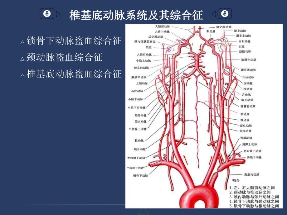 椎基底动脉系统及其综合征参考PPT_第3页