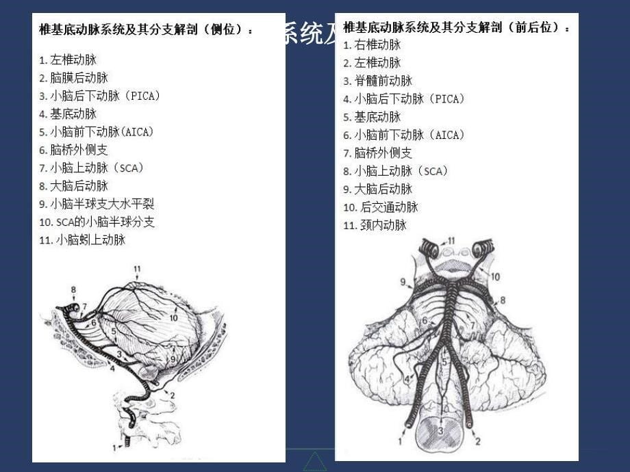 椎基底动脉系统及其综合征参考PPT_第5页