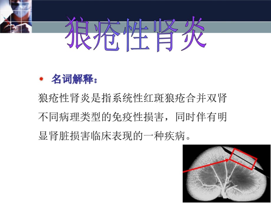 狼疮性肾炎护理说课讲解_第3页