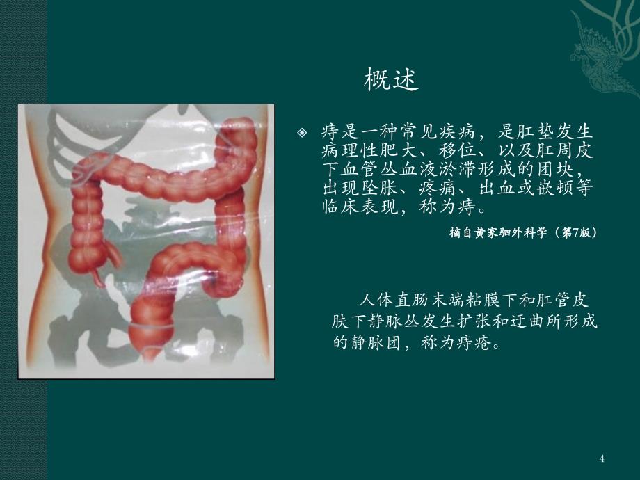 痔诊断和治疗指南ppt医学课件_第4页