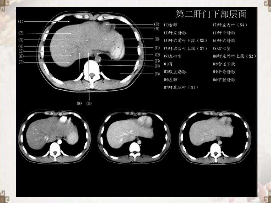 正常肝脏 C T解剖ppt医学课件_第4页