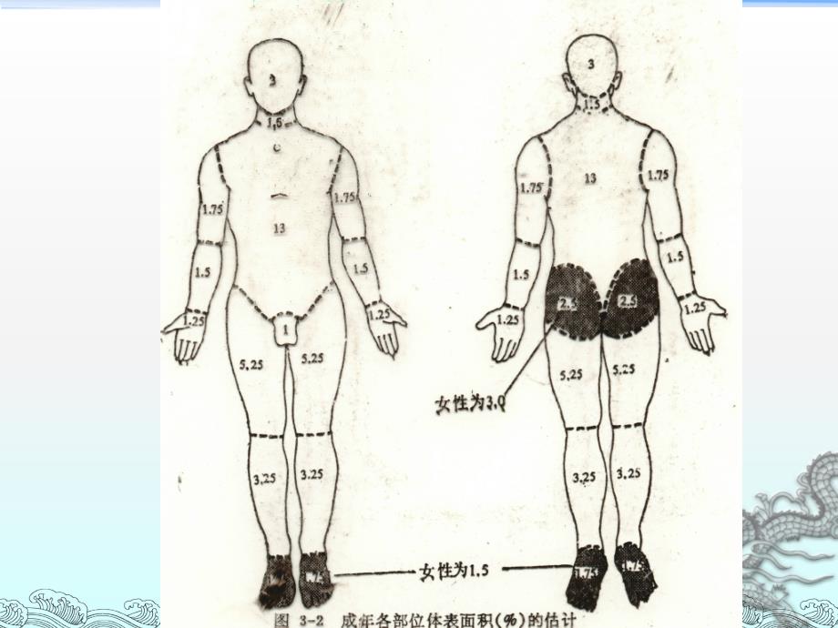 烧 伤ppt医学课件_第4页