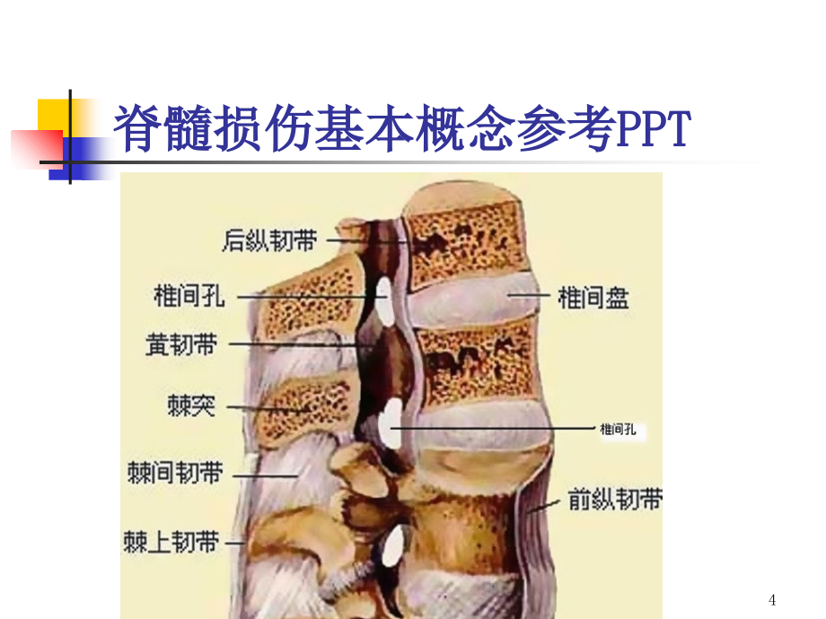 脊髓损伤基本概念参考PPT_第4页