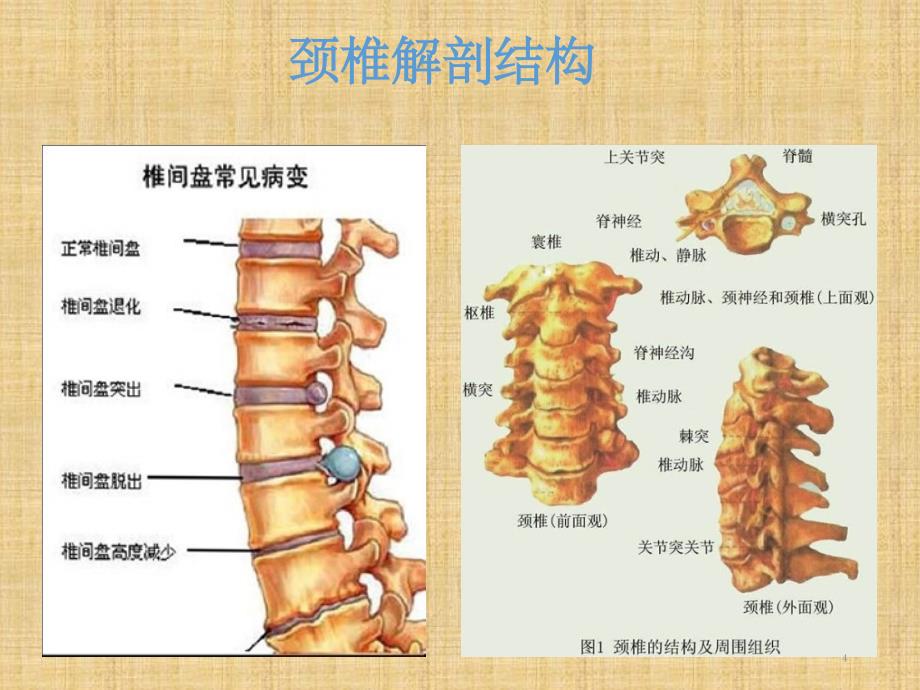 颈椎病诊断与手法治疗参考PPT_第4页